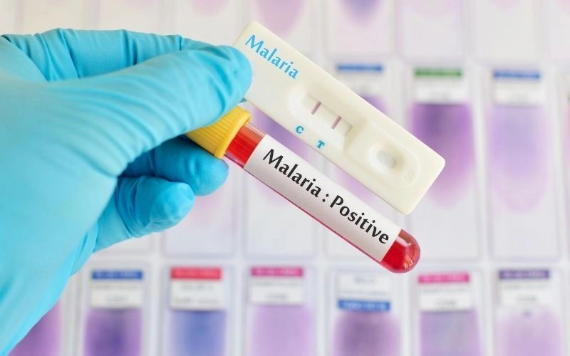 Malaria